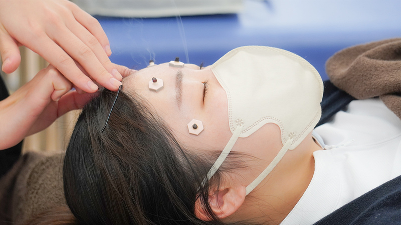 鍼灸学科：美容鍼灸講座